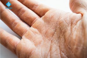 Bị nước rửa bát ăn tay